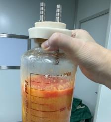 库尔勒水动力吸脂手术要做多久？